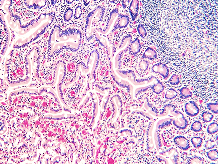 Histopathology